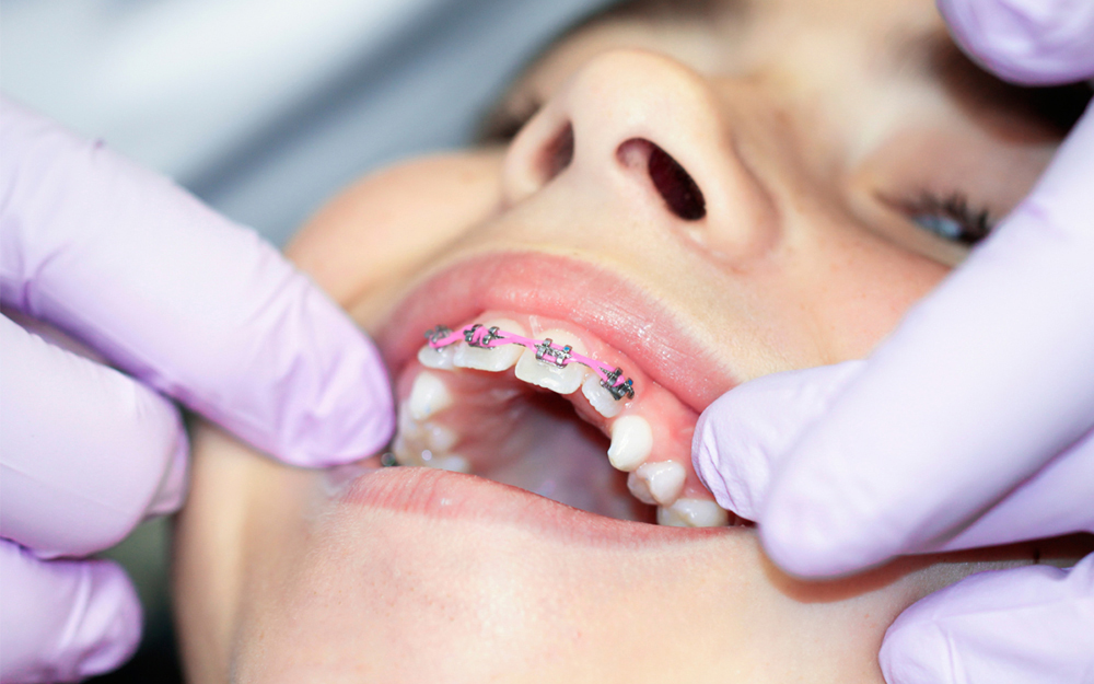 Family dentist in Beamsville Beamstown Dental Group orthodontic treatment consultation room